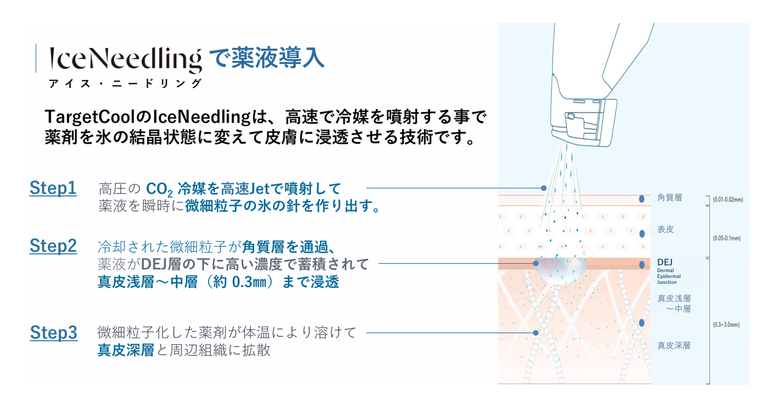 アイスニードリング技術による薬剤導入